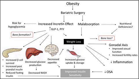 bariatric surgery impact metabolism appetite