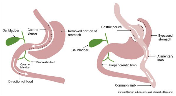 weight set point theory stomach ghrelin cell metabolism body weight glucose metabolism gut hormone