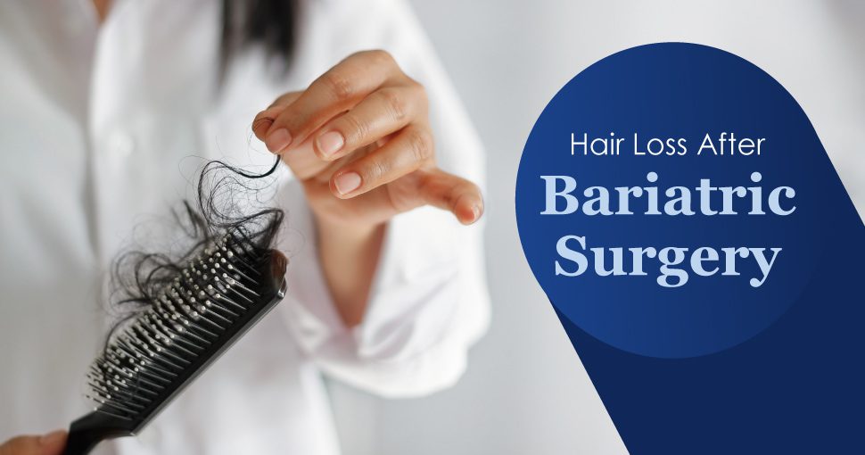 Weight-loss Surgery, Nutrition and Hair Loss - Hair Loss After Bariatric Surgery