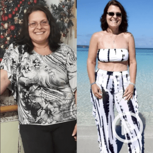 how long is recovery from gastric sleeve surgery