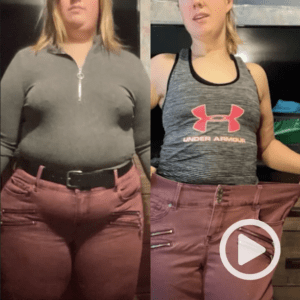 recovery time for vsg gastric sleeve surgery