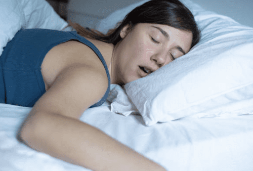 A Canadian woman sleeping and snoring due to sleep apnea. 