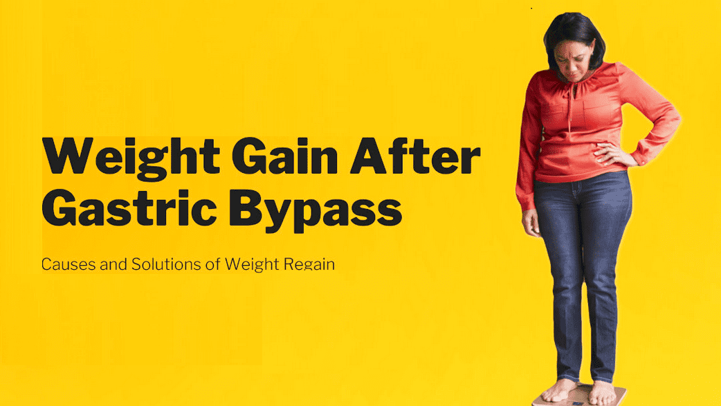 Weight Regain After Gastric Sleeve Surgery - Chances & Causes