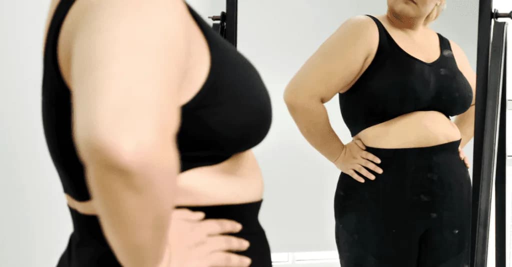 Gastric Sleeve Before And After Skin - The Real Picture
