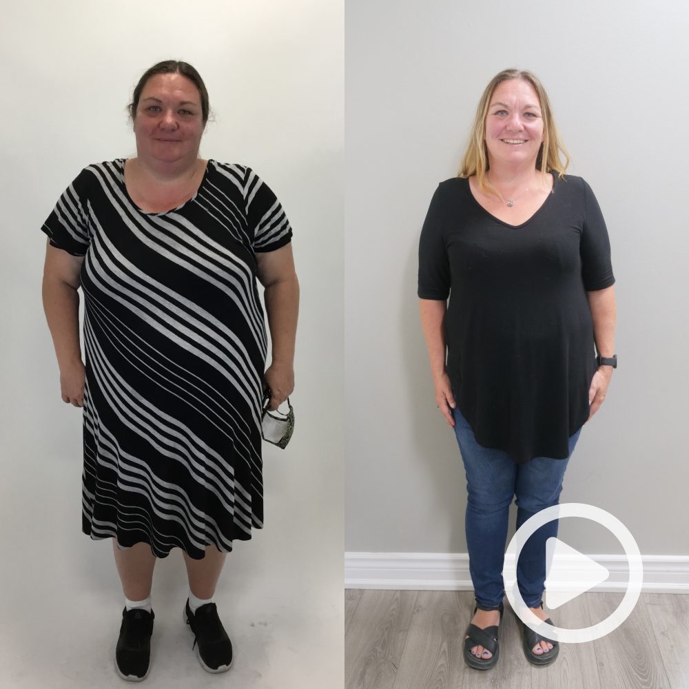 Tara - Lost 100 lbs with gastric sleeve surgery