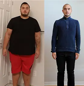 Transformation of Jordan, a patient at Sleeve Clinic before and after undergoing bariatric surgery.