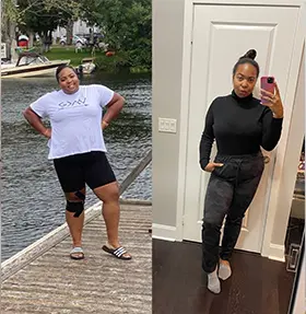 Transformation of Kristina, a patient at Sleeve Clinic before and after undergoing bariatric surgery.