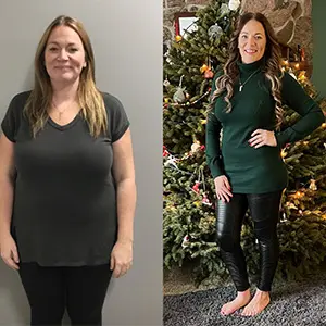Transformation of Lisa, a patient at Sleeve Clinic before and after undergoing bariatric surgery.