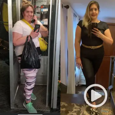 Before and after weight loss transformation photos of Alba Z., a patient of The Sleeve Clinic.