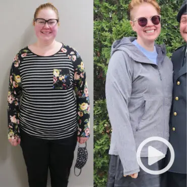 Transformation of Caitlyn, a patient at Sleeve Clinic before and after undergoing bariatric surgery.