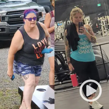 Transformation of Sara, a patient at Sleeve Clinic before and after undergoing bariatric surgery.