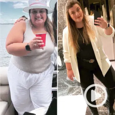 Transformation of Maria, a patient at Sleeve Clinic before and after undergoing bariatric surgery.