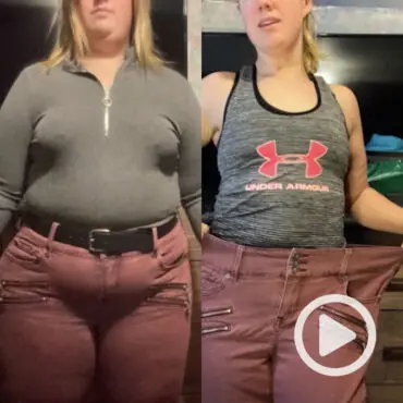 Transformation of Tiffany, a patient at Sleeve Clinic before and after undergoing bariatric surgery.