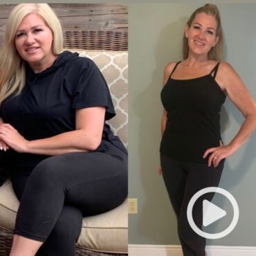 Transformation of Nadine, a patient at Sleeve Clinic before and after undergoing bariatric surgery.