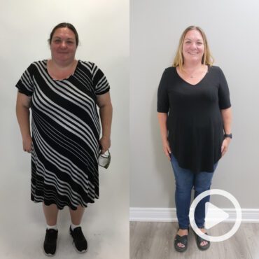 Transformation of Tara, a patient at Sleeve Clinic before and after undergoing bariatric surgery.