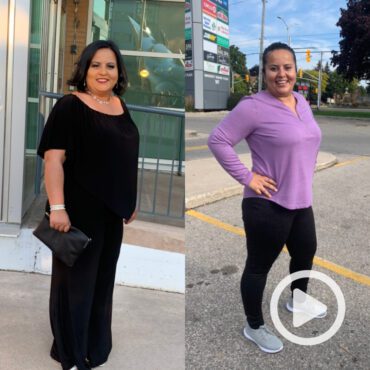 Transformation of Mina, a patient at Sleeve Clinic before and after undergoing bariatric surgery.