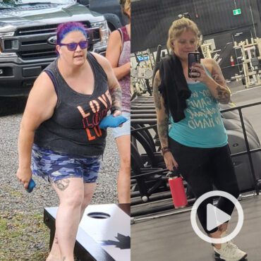 Transformation of Sara, a patient at Sleeve Clinic before and after undergoing bariatric surgery.